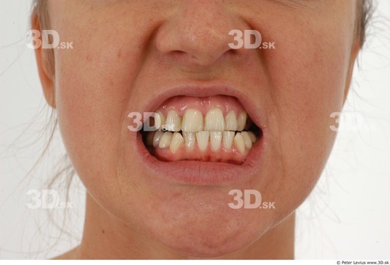 Teeth Woman White Average