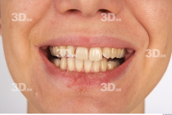 Teeth Woman White Nude Slim