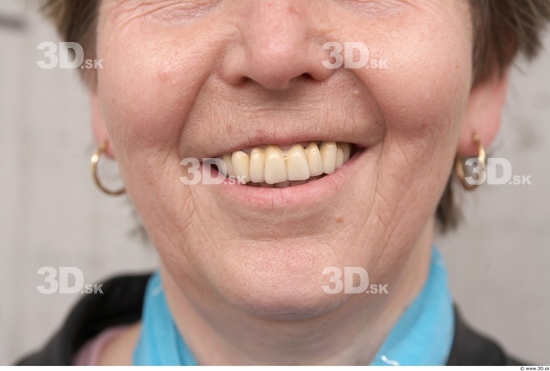 Teeth Woman White Average