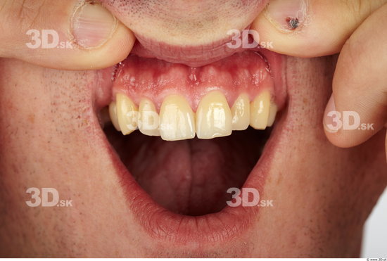 Teeth Man Average Studio photo references