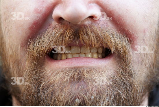 Teeth Man White Overweight Bearded