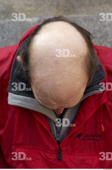 Hair Man White Underweight Bald