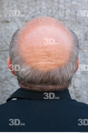 Hair Man White Overweight Bald