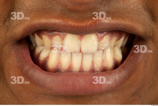 Teeth Black Studio photo references