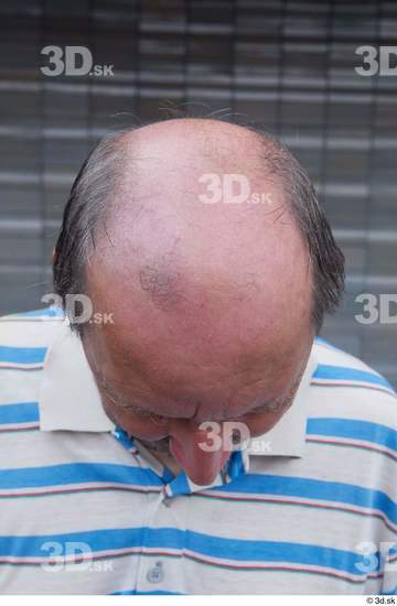 Head Hair Man White Casual Average Bald Street photo references