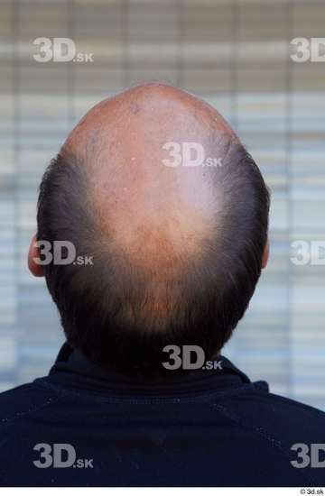 Head Hair Man White Sports Average Bald Street photo references