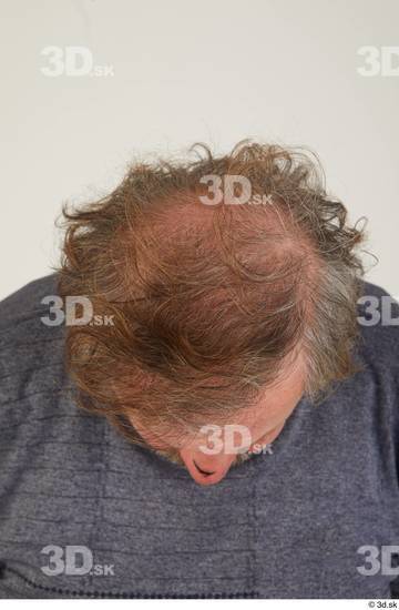 Head Hair Man White Casual Chubby Street photo references