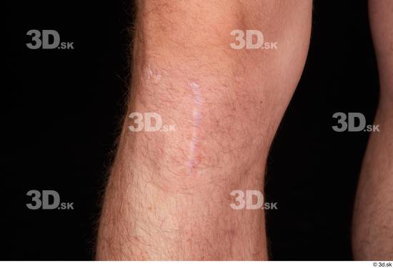 Knee Man White Scar Nude Slim Studio photo references