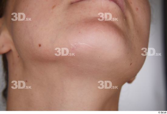 Isabella De Laa chin scar  jpg