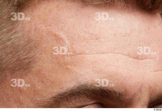 Face Hair Skin Man White Scar Wrinkles Studio photo references