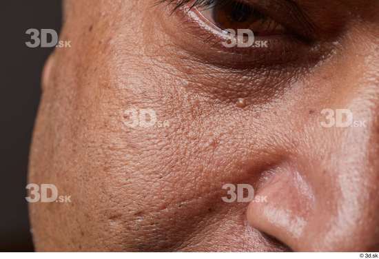 Face Nose Cheek Skin Man Scar Chubby Wrinkles Studio photo references