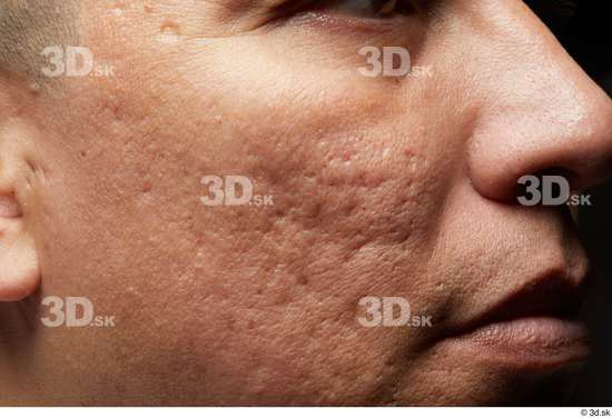 Face Mouth Nose Cheek Skin Man Scar Slim Studio photo references