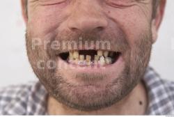 Teeth Man White Casual Average