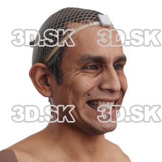 Moises Molina Raw Morph Scan -  Jaw Clencher Teeth