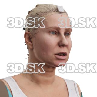 Macy Norman Raw Morph Scan -  Lower Lip Depressor